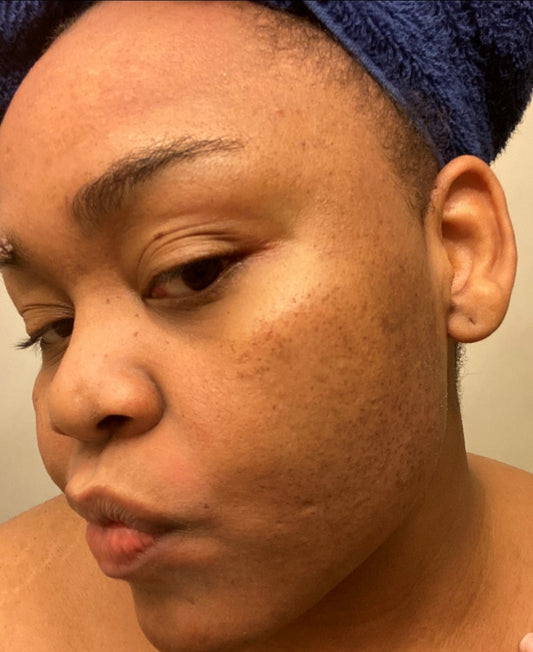 Honey, Aloe facial cleanser